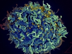 This scanning electron micrograph shows HIV particles infecting a human T cell. Most strains of HIV cannot enter T cells that don't have a CCR5 co-receptor on the surface. Photo: National Institute of Allergy and Infectious Diseases, National Institutes of Health